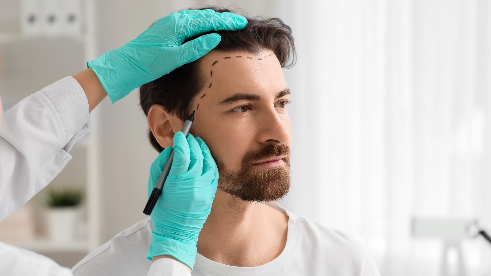 כמה עולה השתלת שיער